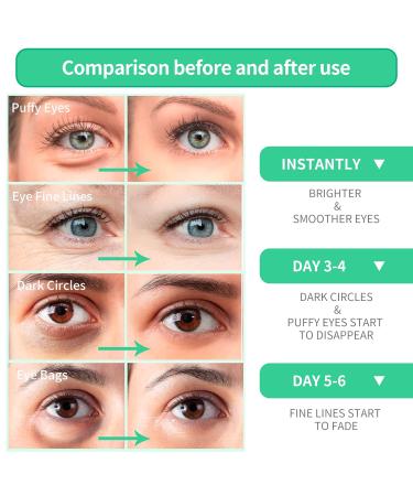 Buy BREYLEE Aloe Vera Eye Masks - 60 Pcs Hydrating & Calming Under Eye Patches for Puffy Eyes | Plant-Based Ingredients for Firm Skin - Buy Online on GoSupps.com