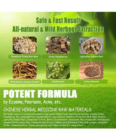 Natural Chinese Herbal Eczema Psoriasis Cream | Anti-Itch Dermatitis Treatment | Moisturizing Ointment for Red, Dry Irritated Skin (1.06oz) - Buy Online on GoSupps.com