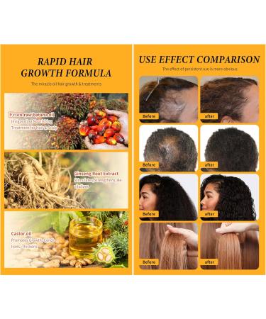 Go Ho Batana Oil for Hair Growth(20g/0.7oz) Organic Batana Hair Oil Prevent Hair Loss Eliminates Split Ends & Increases Shine Batana Oil for Healthier Thicker Fuller Hair - Buy Online on GoSupps.com