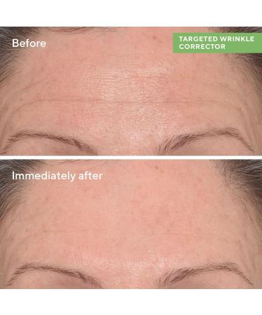MURAD Rapid Wrinkle Repair Kit - Worth 168 Save 40 percent - 2 Full Sizes to Smooth Wrinkles in an Instant and Over Time - Eye Serum - Wrinkle Correcter - Buy Online on GoSupps.com