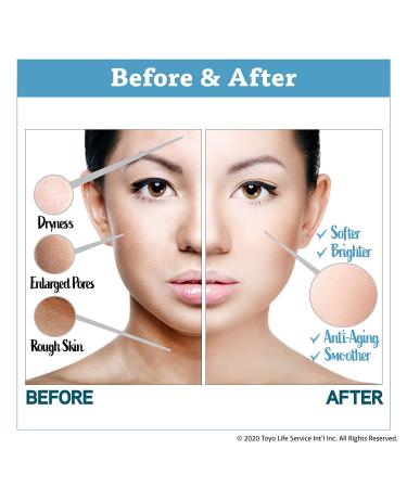 Cure Natural Water Treatment Skin Cream 3.5 oz - Hydrating & Soothing Formula - Buy Online on GoSupps.com