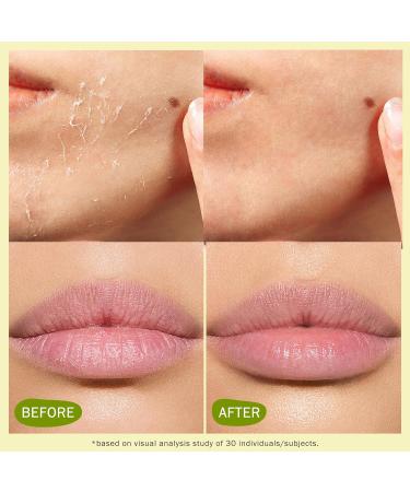 Beef Tallow for Skin: Organic Grass Fed Tallow Cream & Lip Balm Set Natural Dry Skin Moisturizer for Face Body & Lips 2 Ounce (Pack of 2) - Buy Online on GoSupps.com