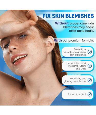 AOBBIY Azelaic Acid Cream: Azelaic Acid For Face - Premium Azelaic Acid Cream - Face Skin and Beauty Care - Azelaic Acid Facial Cream (1 Oz) - Buy Online on GoSupps.com