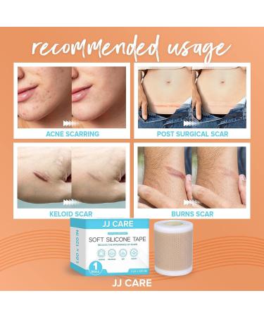 JJ CARE 1.6 x 120 Soft Silicone Scar Tape - Flexible, Washable & Reusable Medical Grade Strips for Surgical Scars - Latex-Free Silicone Tape - Buy Online on GoSupps.com