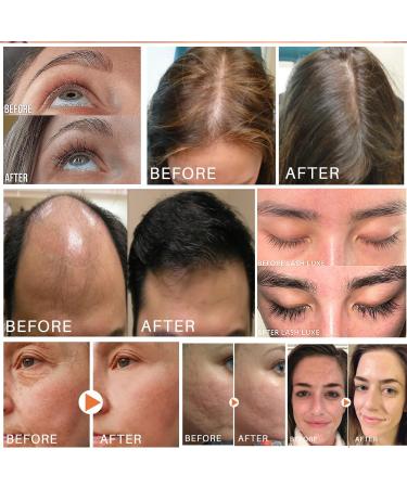 Pumpkin Seed Oil for Hair Growth: Organic Nourishing 60ml Formula to Enhance Hair Vitality and Scalp Health - Buy Online on GoSupps.com