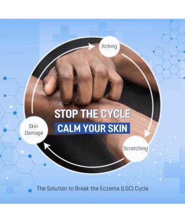 ABERA Seborrheic Dermatitis Cream Relief for Psoriasis & Eczema with Peptizinc + Herbal Complex Neurodermatitis Comfort Soothes Itching Face Scalp & Body Daily Relief Steroid Free (1.01 Fl Oz) 1 Box - Buy Online on GoSupps.com