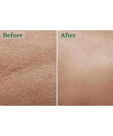 Shea Organics Colloidal Oatmeal Body Moisturizer | Soothes Dry & Sensitive Skin | Eczema & Psoriasis Relief | Lightweight & Steroid-Free | 8 Oz - Buy Online on GoSupps.com