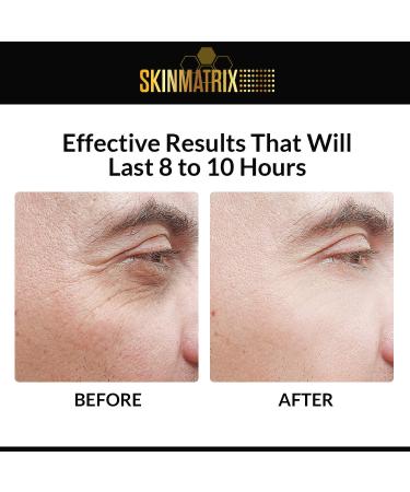 Puffy Eyes Treatment Serum with Hyaluronic Acid & Vitamin C - Anti Aging Under Eye Cream for Dark Circles, Fine Lines, Wrinkles & Bags - Instant Results - Buy Online on GoSupps.com