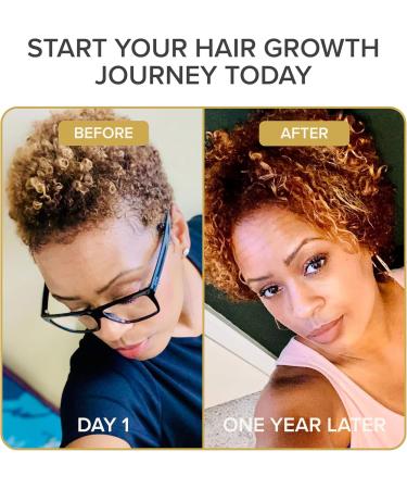 Shedavi Iconic Natural Hair Vitamins for Fast Hair Growth - Pure Hair Supplements Formulated with Vitamins to Promote Thicker Stronger Hair - Vegan Hair Care for Hair Loss - Non-GMO (60 Capsules) - Buy Online on GoSupps.com