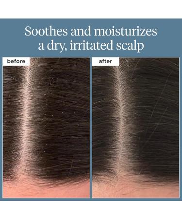 Briogeo Scalp Revival Rosemary Pre-Wash Oil | Vegan Dry Scalp Treatment for Stronger Hair | 3.4 fl oz - Soothe & Moisturize - Buy Online on GoSupps.com