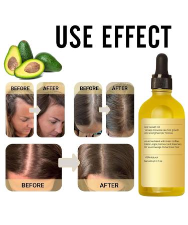 Veganic Organic Hair Repair Oil - Revitalize Thin Dry Damaged Hair with Rosemary Oil (2PCS) - Enhance Hair Health - Buy Online on GoSupps.com
