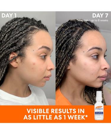 Palmer's Skin Success Extra Strength Face Serum - Dark Spot Corrector for Discoloration & Age Spots | 1.0 Fl Oz - International Shipping Available - Buy Online on GoSupps.com