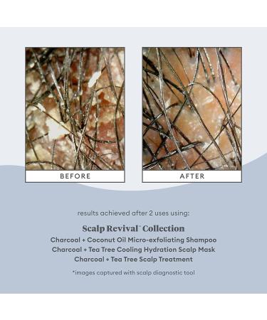 Briogeo Scalp Revival Charcoal + Coconut Oil Micro-Exfoliating Shampoo | Scalp Scrub for Dry, Flaky, Itchy Scalp | Vegan, Phthalate & Paraben-Free | 8 oz - Buy Online on GoSupps.com