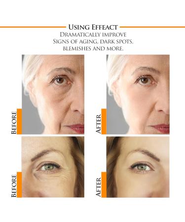 Kanzy Vitamin C Serum 20% with Hyaluronic Acid - Anti-Aging, Anti-Wrinkle, Dark Circles & Fine Lines - 30ml - Buy Online on GoSupps.com