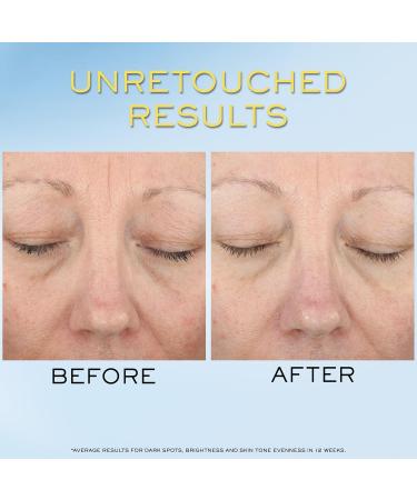 Lanc me Supra Screen Invisible Serum Sunscreen SPF 50+ - Anti-Aging Correction & Protection - For All Skin Types - 48 HR Hydration Radiant Finish - Buy Online on GoSupps.com