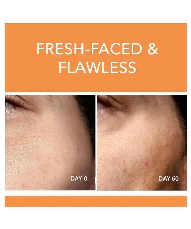 Go Beauty 3-Step Treatment Regimen Bundle - 1fl oz Vitamin C Serum for Boosting Collagen & Elasticity 1 oz COQ 10 Serum for Energized Skin & 1 oz Hyaluronic Acid Serum for Dry & Dull Skin - Buy Online on GoSupps.com