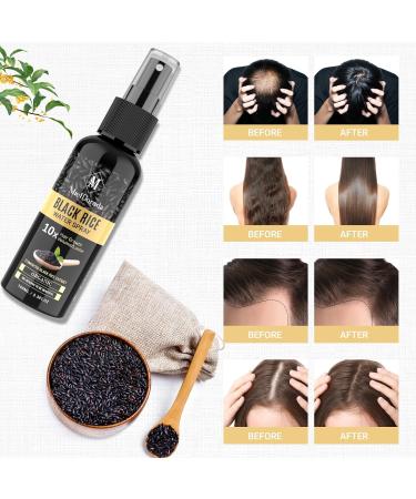 Black Rice Water Hair Growth Serum | Non-Greasy Fermented Treatment for Hair Loss & Regrowth in Men & Women - Buy Online on GoSupps.com