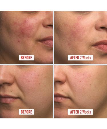 First Aid Beauty Ultra Repair Cream 8 oz: Intense Hydration Moisturizer for Face and Body - Buy Online on GoSupps.com