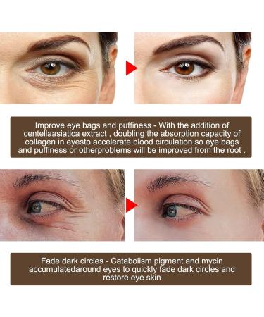 Keptfeet Anti-Aging Eye Cream - Fast Wrinkle Repair for Dark Circles & Swelling | 20g Youthful Skin Treatment - Buy Online on GoSupps.com