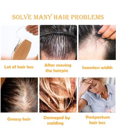 Ginger Hair Growth Shampoo - Natural Anti Hair Loss Treatment for Women & Men - Buy Online on GoSupps.com