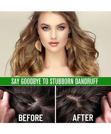 Batana Oil for Hair Growth Organic Cold Pressed 100% Pure Batana Oil Prevents Hair Loss & Repairs Damaged Hair Nourishing Hair Oil for Men & Women All Hair Types 60ml - Buy Online on GoSupps.com