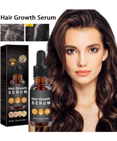 Hair Growth Serum for Black Women Hair Growth Oil New Hair Growth Serum Anti Hair Loss Nourishes Dry and Damaged Hair - Buy Online on GoSupps.com