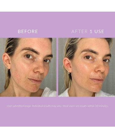 Kate Somerville DeliKate Recovery Cream 1.7 Fl Oz - Hydrating Treatment for Stressed Skin - Buy Online on GoSupps.com