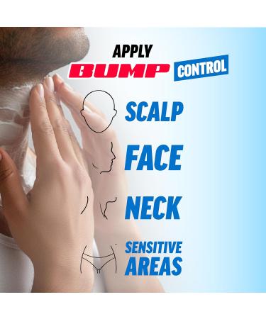 Nyxon Cosmetics Nyxon Bump Control 75ml The Razor Bump Solution Pack van 3 - Buy Online on GoSupps.com
