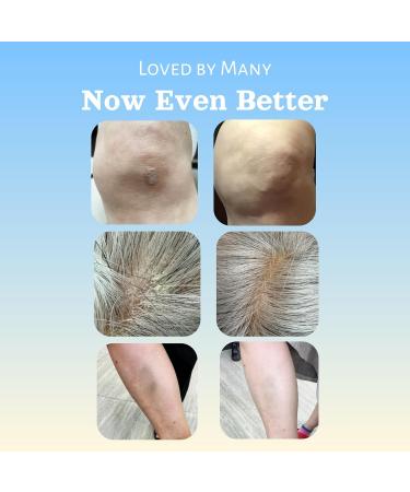 Natural SKIN REPAIR. Clinically tested Aromatherapy. Powerful Essential Oil. Eczema Dermatitis Diaper rash and Sensitive skin. For all skin types. Hypoallergenic Vegan Paraben Free. 50ML TUBE Tube 50ml - Buy Online on GoSupps.com