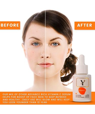 zoomt Vitamin C FACE SERUM Anti-wrinkle Serum- Face moisturiser Radiant - Buy Online on GoSupps.com