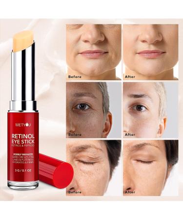 Retinol Eye Stick - Cooling & Brightening Cream for Dark Circles, Puffiness & Bags - with Peptides & 5% Hyaluronic Acid - SPF 30+ - 0.1oz - Buy Online on GoSupps.com