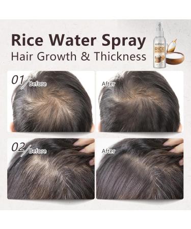 LIESE Rice Water Serum with Rosemary Oil - Hair Growth Treatment for Men & Women - 1.7 FL OZ - Buy Online on GoSupps.com