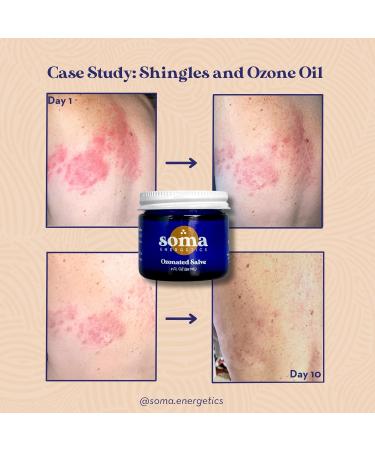 Ozonated Organic Salve for Skin Repair | Joint Pain Relief & Eczema Treatment | 2 oz Natural Healing Balm - Buy Online on GoSupps.com