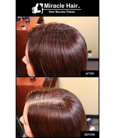 Premium All Hair Building Fibers - Medium Brown (10g) | Thicker Hair 75-Day Supply - International Shipping - Buy Online on GoSupps.com