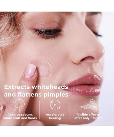 OMMA Pimple Stickers - Hydrocolloid Acne Treatment | 72 Korean Zit Patches with Salicylic Acid for Spot Treatment & Whitehead Extraction - Buy Online on GoSupps.com
