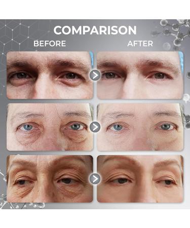 Abera Eye Revitalizing Essence, Anti-Aging Treatment with Bakuchiol and Black Ginseng, Dark Circles and Fine Lines 0.51 fl oz A. Combo 1 - Buy Online on GoSupps.com