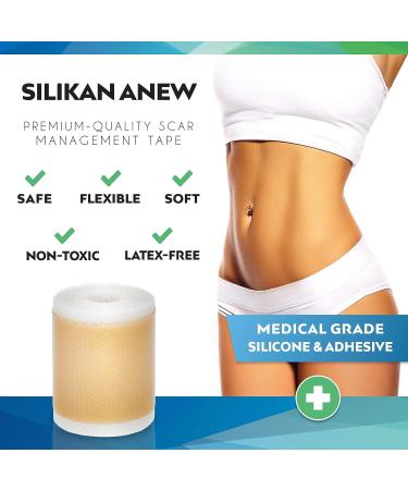 Silikan Silicone Scar Tape - Skin Color Roll 1.6 X 60, Medical Grade for Surgery Scars, Soft Thin Silicone Adhesive for Scar Recovery - 4 Months Supply - Buy Online on GoSupps.com
