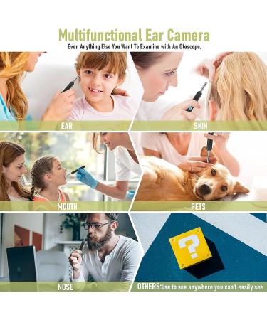 Smart Wireless Ear Wax Removal Tool Camera | Visual Ear Cleaner Kit for Babies, Kids, Adults, Pets | 1296P Ear Otoscope Scope with Cleaning Tool - Buy Online on GoSupps.com