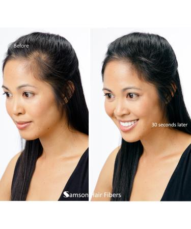 Refill kit Hair Fiber By Samson XLarge 50 Grams Hide Hair Loss and Hair Transplant Natural Looking Results Made in USA Hair Loss Concealer (Dark Brown) - Buy Online on GoSupps.com