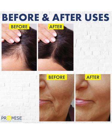 270ml (9oz) PURE COCONUT FRACTIONATED MCT OIL Moisturizes & Nourishes Hair Face and Skin UV Protected Non GMO Made in Canada (270ml) 270 ml (Pack of 1) - Buy Online on GoSupps.com