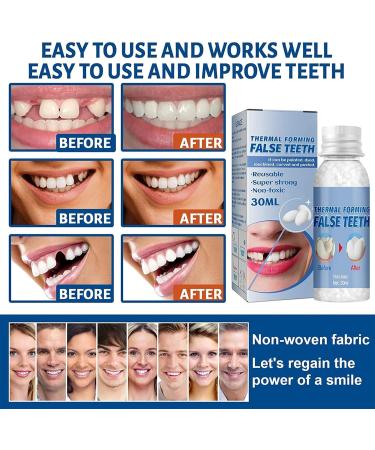 Temporary Teeth Instant Veneers | WTTFC Thermal Adhesive Beads for Tooth Repair | 60g Fake Tooth Filling Set - Buy Online on GoSupps.com