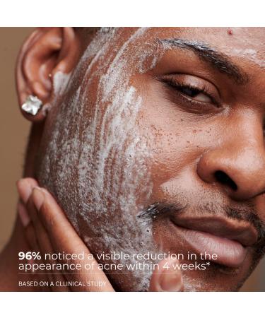 Anti-Blackhead Deep Pore Face Wash | Oily Skin Cleanser with Zinc & Salicylic Acid | Reduces Blackheads & Unclogs Pores | 150ml - Buy Online on GoSupps.com