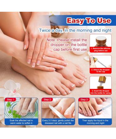 Buy Extra Strength Toenail Fungus Treatment - Fast Acting Nail Fungus Remover for Men & Women - 30mL Liquid Solution - Buy Online on GoSupps.com