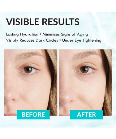 Wake Skincare Eye Gel - Hydrating Serum for Dark Circles, Puffy Eyes & Bags - 15ml Anti Aging Gel - Buy Online on GoSupps.com