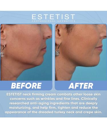 Neck Firming Cream for Tightening Sagging Skin - Anti Wrinkle & Aging Treatment with Vitamin C & Coconut Oil - Double Chin Reducer for Neck & Decolletage - Buy Online on GoSupps.com