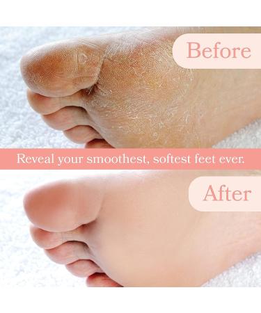 Pedi Peach Professional Electric Foot Scraper - Callus & Corn Remover for Dead Skin - Portable Pedicure Kit - Buy Online on GoSupps.com