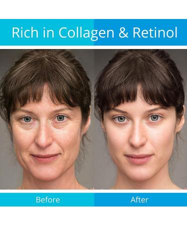 Anti-Aging Retinol & Collagen Face Cream for Women & Men - 50ml - Buy Online on GoSupps.com