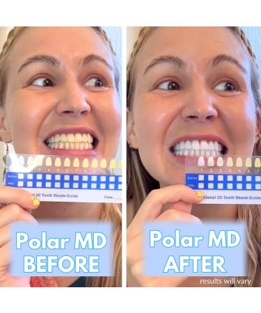 Polar MD Teeth Whitening Kit - Professional Gel Pens 1 Year Supply 32 LED Wireless Light - Compare to Whitening Strips - Buy Online on GoSupps.com