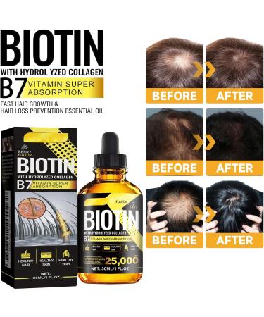  MagiSel Anti Hair Loss Lotion Men Women 30ml Essence for Hair Growth Fast Growth Hair Treatment Hair Growth Serum Anti Hair Loss for Women - Buy Online on GoSupps.com