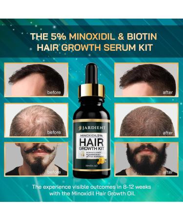 Minoxidil & Biotin Hair Growth Oil for Beards - Prevent Hair Thinning | 5% Minoxidil 1 Fl Oz - For Men & Women - Buy Online on GoSupps.com